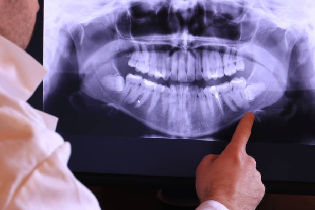 Best Teeth Whitening  in Columbia, MO