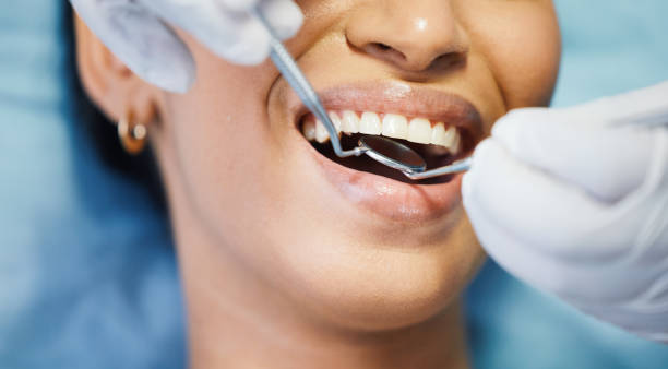Best Root Canal Emergency Dentist  in Columbia, MO