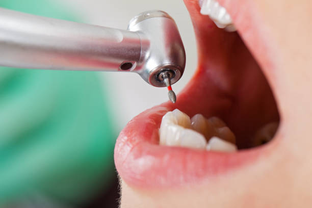 Best Urgent Tooth Repair  in Columbia, MO